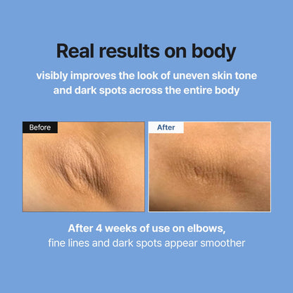 Retinal Skin Booster Serum | Retinaldehyde, Niacinamide Anti-Aging Serum - K-Beauty Facial Serum for Fine Lines, Firming & Radiance | Hydrating Face Serum All Skin Types, 5.07 Fl Oz