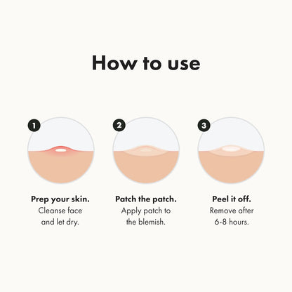 Original from Hero Cosmetics - Hydrocolloid Acne Pimple Patch for Zits and Blemishes, Spot Treatment Stickers for Face and Skin, Vegan and Cruelty Free (36 Count)