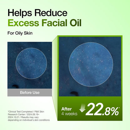 Azelaic Acid 10 Hyaluron Redness Soothing Serum, Facial Serum for Blemish-Prone & Oily-Prone Skin, Lightweight & Hydrating Blemish Care, Hyaluronic Acid, Korean Skincare, 1.01 Fl Oz.