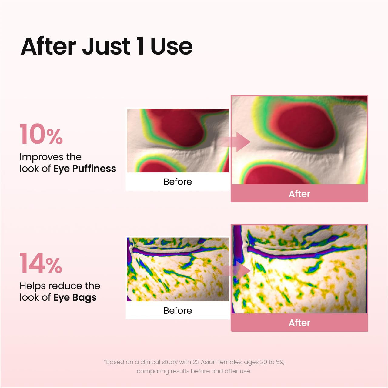 Collagen Peptide Eye Patches, anti Wrinkle & Smile Line Patches for Face, under Eye Mask for Fine Lines & Eye Bags, Travel Essentials & Self Care Gifts for Women, Korean Skin Care (60 Count)