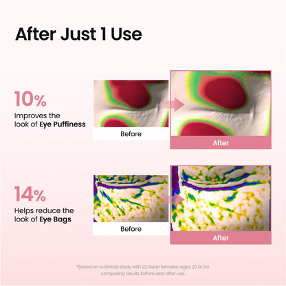 Collagen Peptide Eye Patches, anti Wrinkle & Smile Line Patches for Face, under Eye Mask for Fine Lines & Eye Bags, Travel Essentials & Self Care Gifts for Women, Korean Skin Care (60 Count)