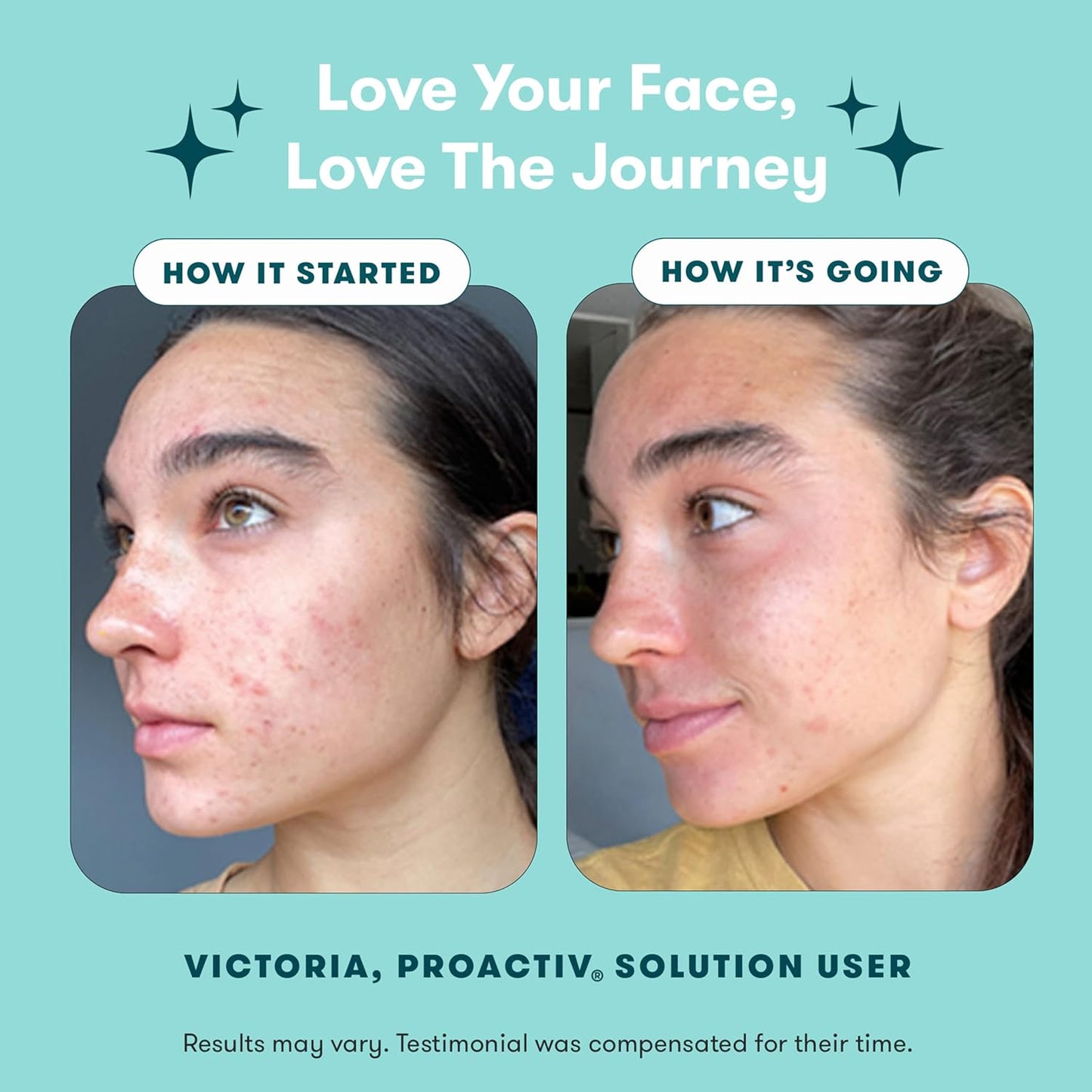 3 Step Acne Treatment - Benzoyl Peroxide Face Wash, Repairing Acne Spot Treatment for Face and Body, Exfoliating Toner - 30 Day Complete Acne Skin Care Kit
