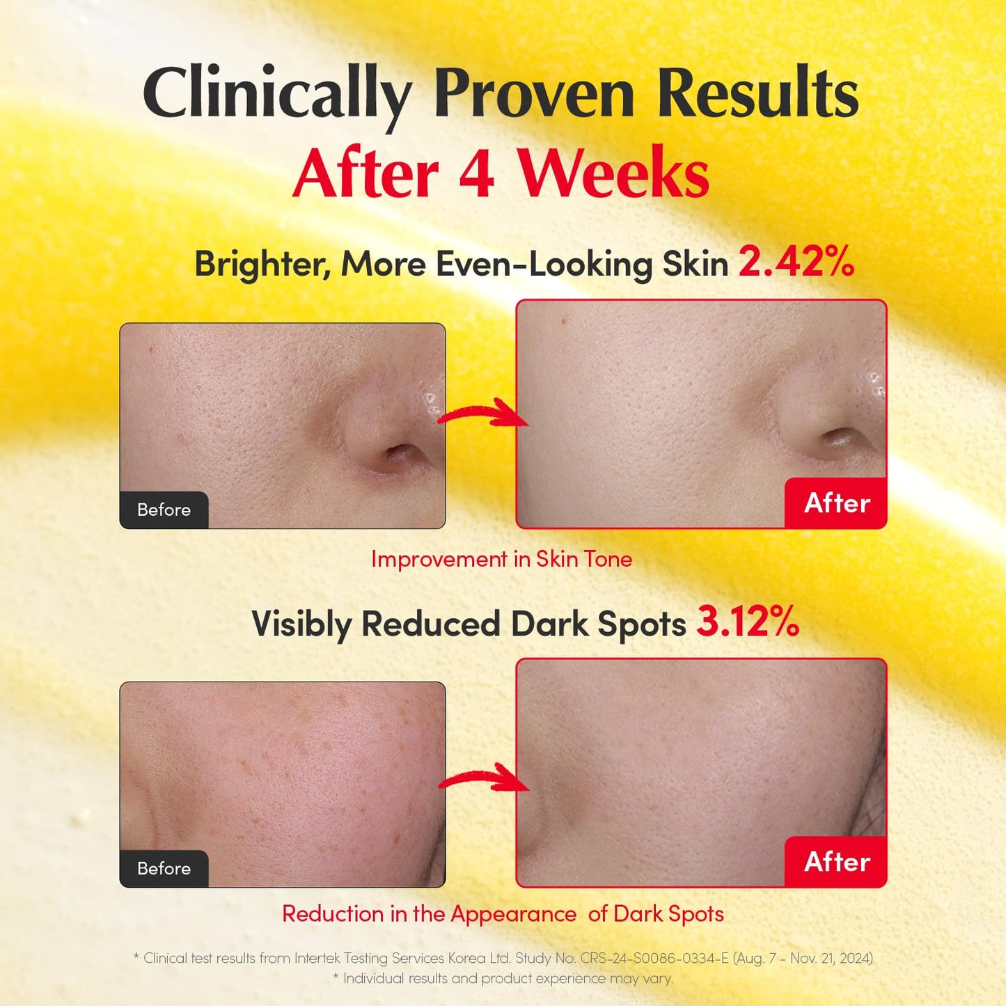 Vitamin Illuminating Serum | Niacinamide 4% & TXA | Brightening Vitamin C Serum for Face Glow with Hyaluronic Acid | Dark Spot & Uneven Tone Care | Korean Skincare, 1.01 Fl Oz