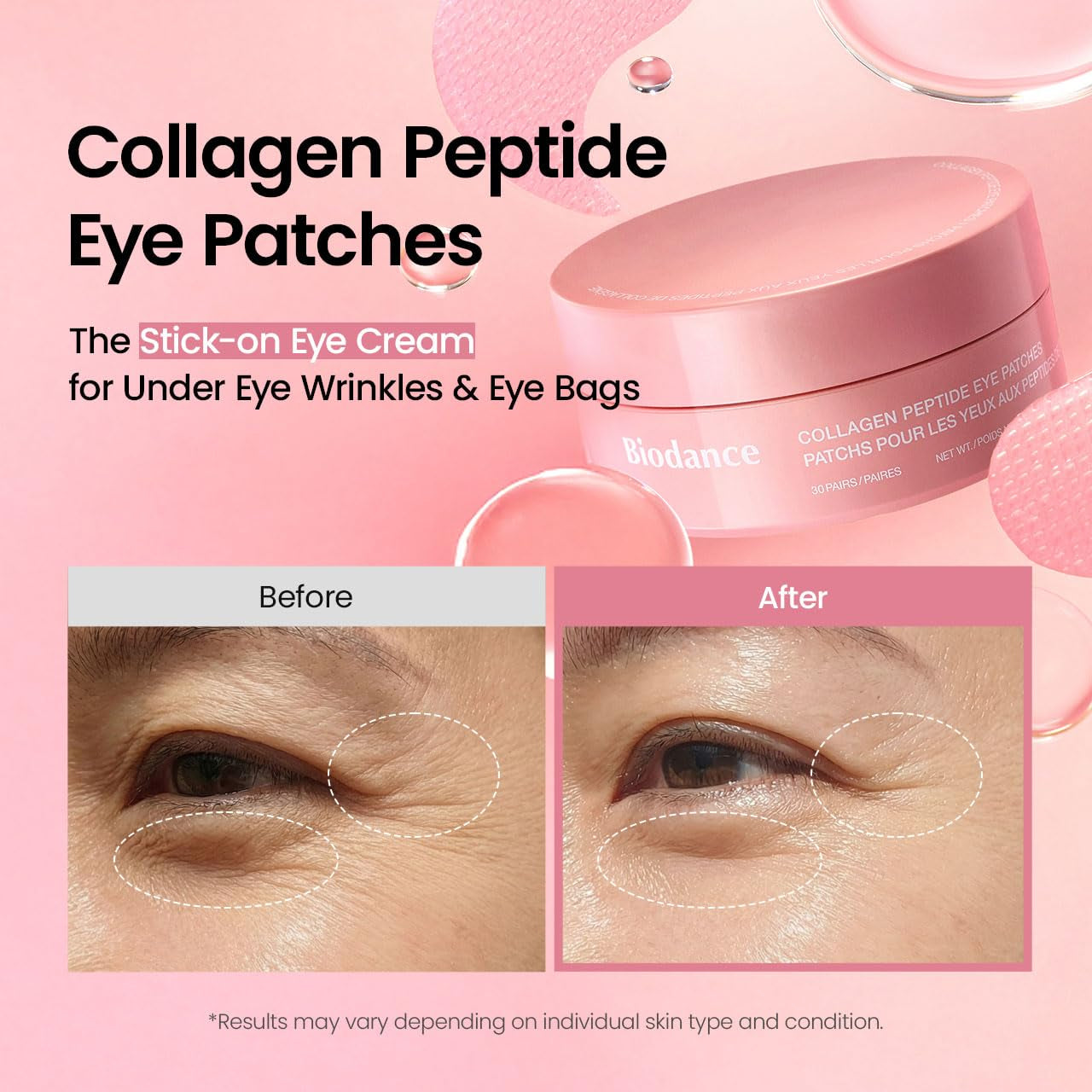 Collagen Peptide Eye Patches, anti Wrinkle & Smile Line Patches for Face, under Eye Mask for Fine Lines & Eye Bags, Travel Essentials & Self Care Gifts for Women, Korean Skin Care (60 Count)